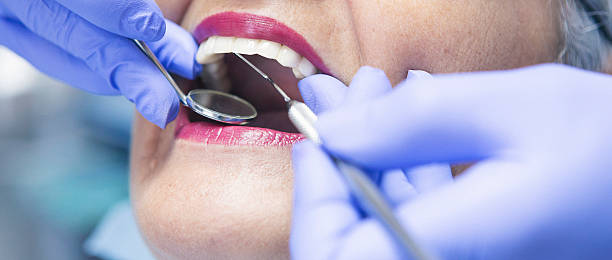 Best Emergency Tooth Extraction in Cisco, TX